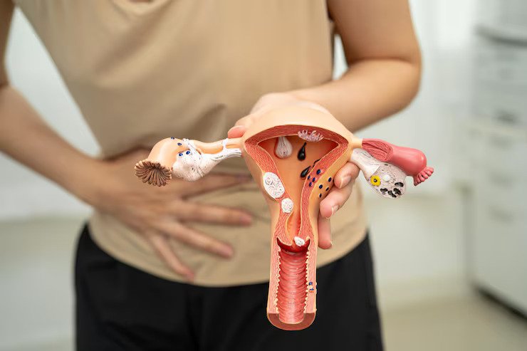 Endometerial Ployps Baner