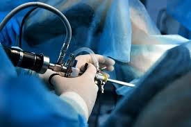 Dilation and curettage